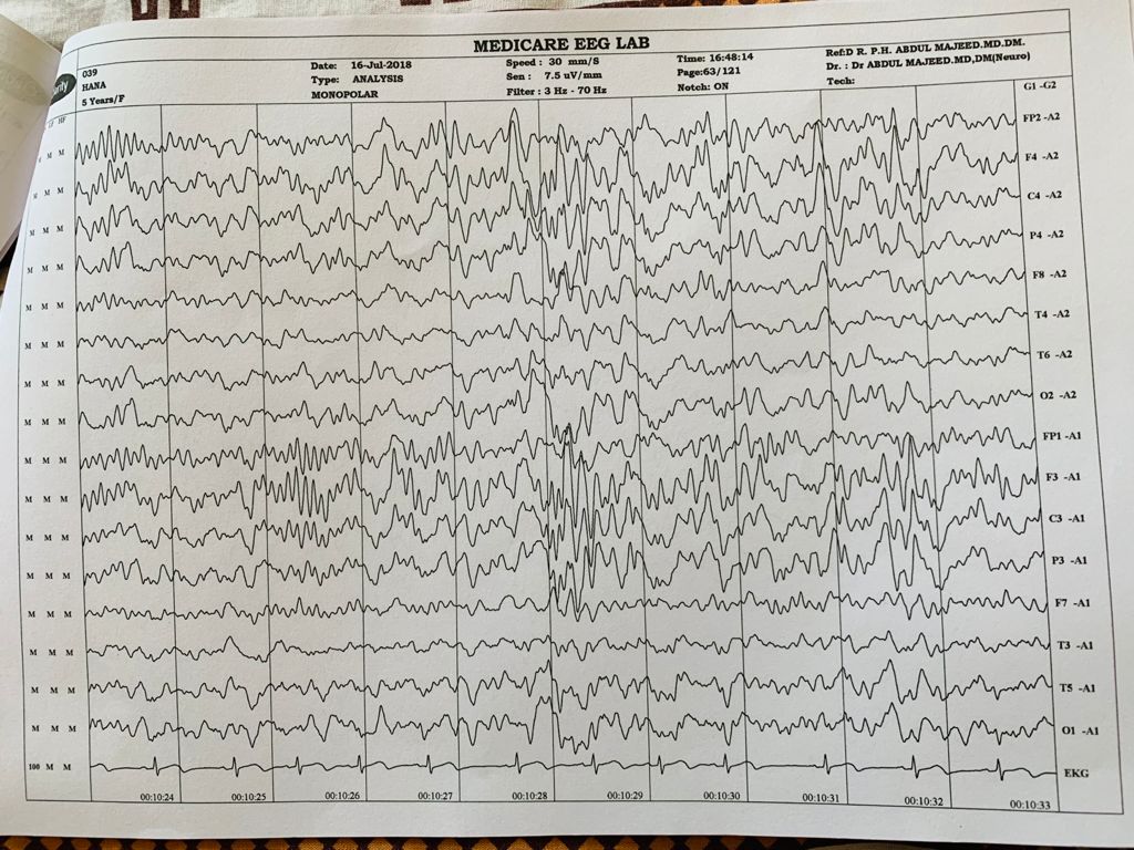 Patient Story
